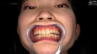 [伊織ひなの][Teeth/Oral] Super rare o...