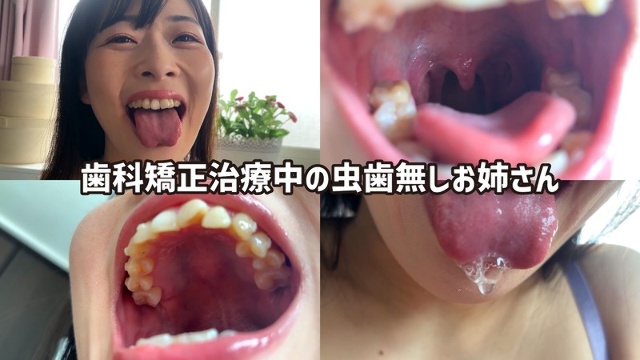 Miori, a part-time worker at a fast food restaurant, approaches me on a street corner and lets me observe her mouth.