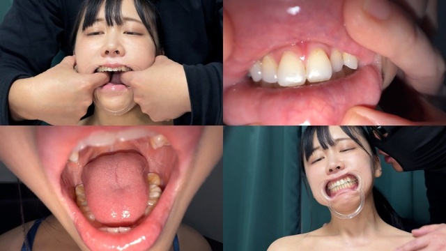 Observation of Suzu's drooling mouth