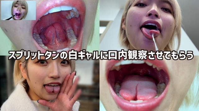 Haruno-chan, a beauty club member, approaches me on a street corner and lets me observe her mouth.