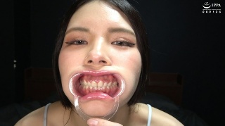 [叶芽遥希]"[Teeth/Oral] Super ...
