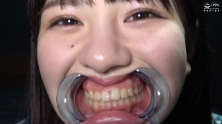 [春日えな]Super Rare Mouth, Teeth, ...