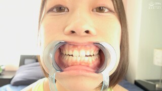[奈築りお]【歯・口内】奈築りおチャンの激レア 歯・口内・舌ベ...