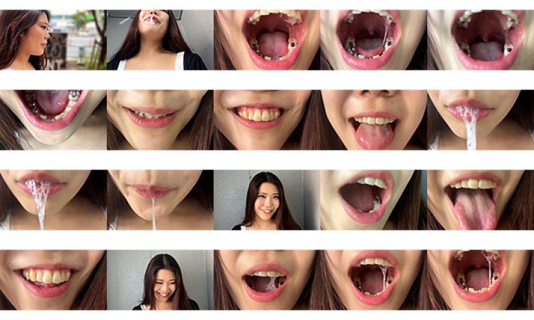 Sayuri, an apparel store clerk, called out to me on the street and got me to observe my mouth:Image