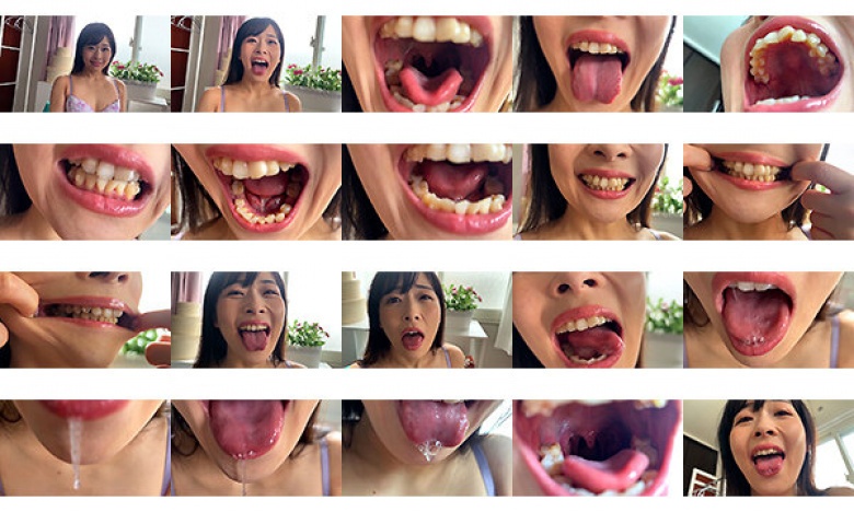 Miori, a part-time worker at a fast food restaurant, approaches me on a street corner and lets me observe her mouth.:Image