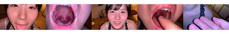 Tsugumi Mizusawa's Throat Blame Swollen Tonsils...:Image