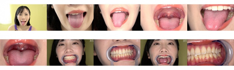 歯・口内・のどちんこ・唾観察 角名つむぎ:サンプル画像