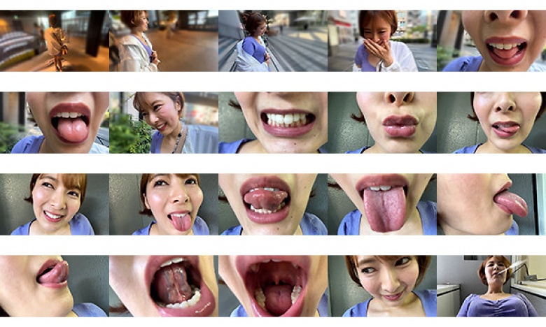 Satsuki-chan, an apparel store clerk, called out to me on the street and got me to observe my mouth.:Image
