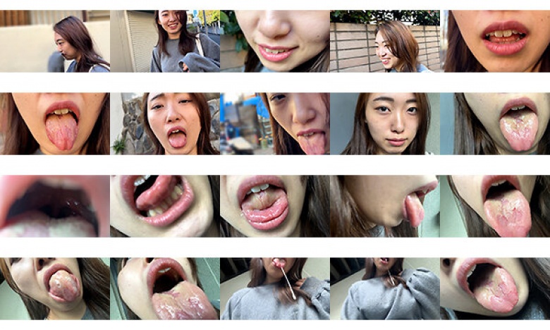 街角で声をかけて口内観察させてもらう 大学生 ゆゆちゃん:サンプル画像