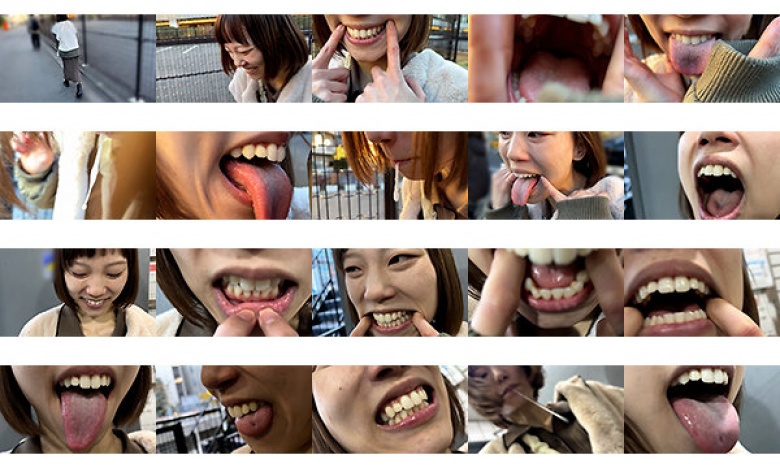 街角で声をかけて口内観察させてもらう オーガニックスーパー勤務 はつみちゃん:サンプル画像