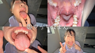[谷田かりな]【個人撮影】谷田かりな 開口器で口内観察デカ舌を要...